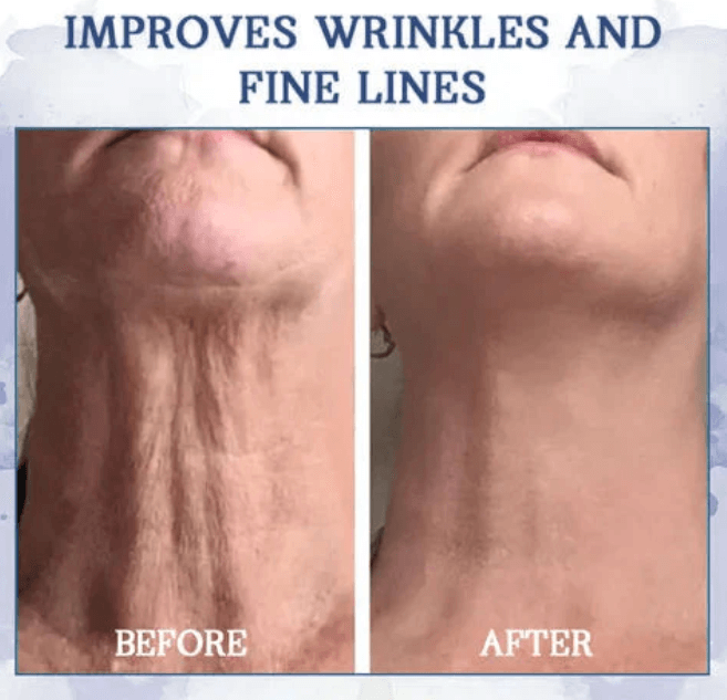 Advanced Firming & Wrinkle-Reducing Cream