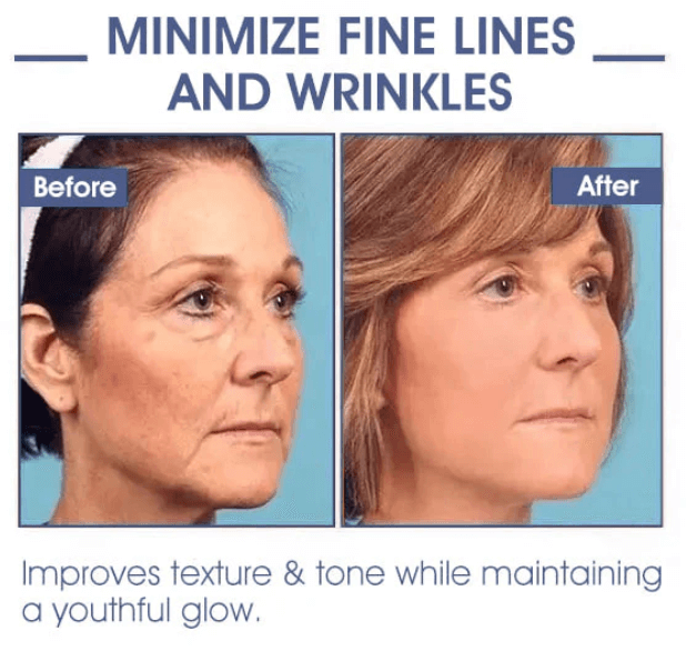 Advanced Firming & Wrinkle-Reducing Cream